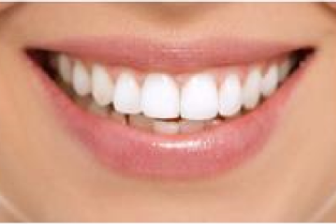 ホワイトニングのページはこちらから ホワイトニングのページはこちらから